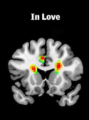 MRI scan of a brain in love